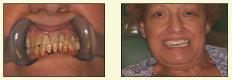 The image is a split-screen photograph showing a person with an open mouth and teeth, likely for dental examination or treatment, on the left side, and a smiling elderly woman on the right.