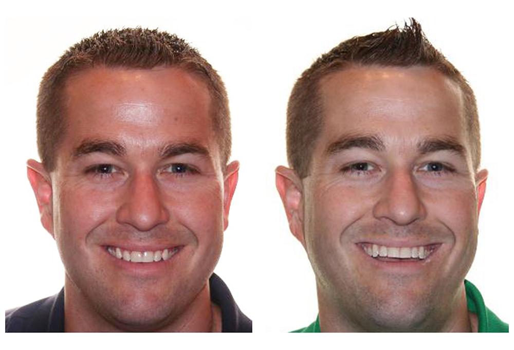 North Broad Family Dental   Orthodontics