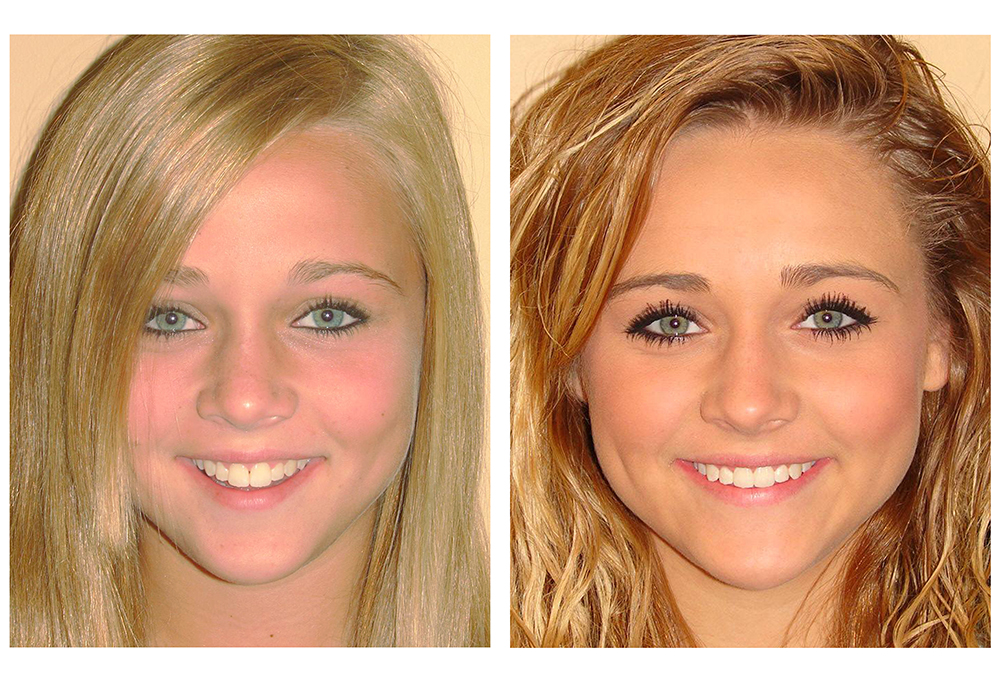 North Broad Family Dental   Orthodontics