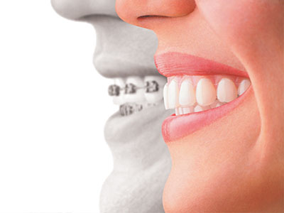 The image shows a split view of a person s face, with one half showing a smiling mouth and the other half displaying a dental implant.