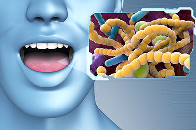 The image features a 3D rendering of a human face with an open mouth, displaying a graphic representation of bacteria or microorganisms.