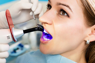 A woman in a dental chair receiving a teeth cleaning procedure, with a dental hygienist using an electric toothbrush and purple dye to highlight plaque.