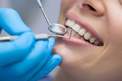 A dental professional performing a cleaning or examination on a patient s teeth, with the patient smiling and wearing protective gloves.