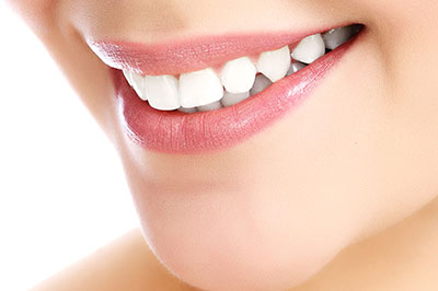 The image shows a close-up of a person s face, focusing on their smile and teeth, with an emphasis on oral hygiene.