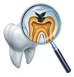 The image is a digital illustration featuring an enlarged human tooth with its internal structure visible, including the root and pulp chamber. A magnifying glass with a transparent handle is superimposed on the tooth, focusing on the pulp chamber, which contains a depiction of a tooth nerve and blood vessels.