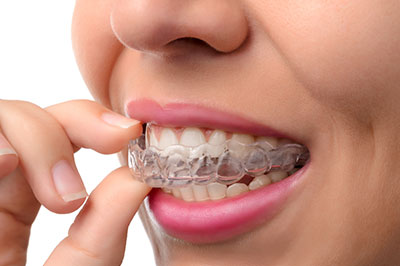 The image shows a person with braces, looking down at their hands.