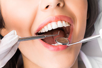 A smiling woman with a mouth full of dental implants or prosthetic teeth, receiving dental care in a professional setting.